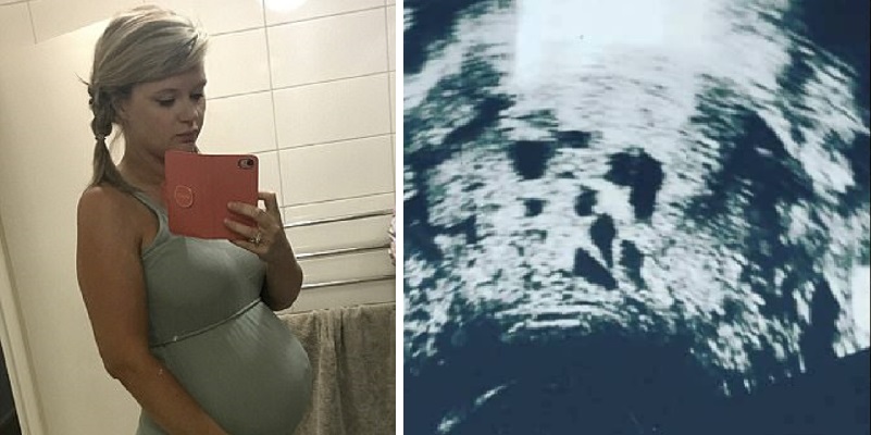 Crede di essere incinta, ma la vita aveva altri programmi per lei