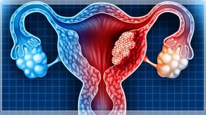 Tumore ovarico, sintomi e diagnosi: arriva l’app che può aiutarvi